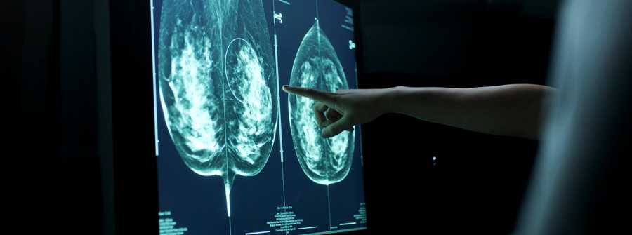 What happens at a breast screening appointment