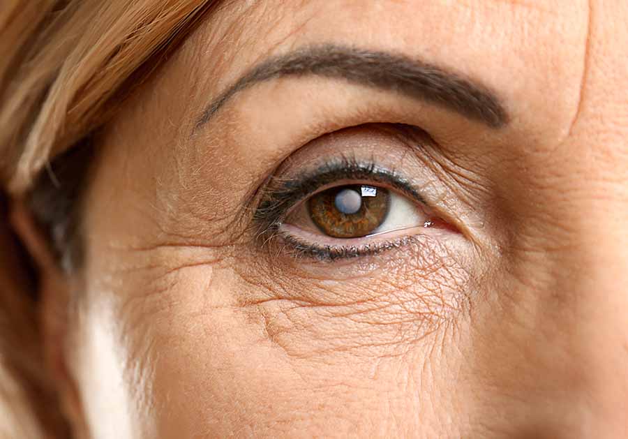 Is cataract surgery painful, and how long does the procedure take?