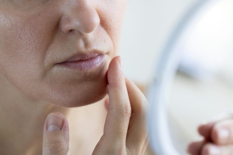 Doctor highlights 5 potentially serious skin changes to look out for