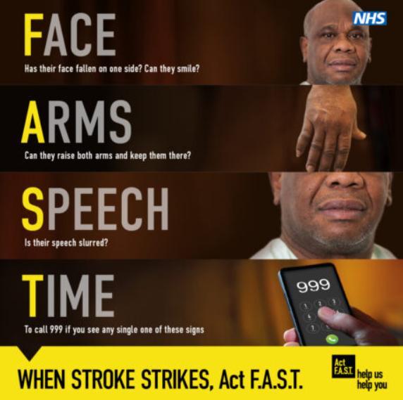 What are the symptoms of a TIA